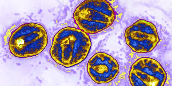 HIV particles pictured use a receptor called CCR5 to infect human cells. A particular mutation in this receptor makes cells resistant to the virus. Image credit James Cavallini Science Source SPL.600x300